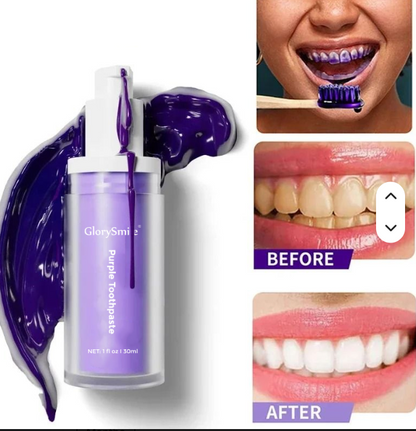 Pasta Dental Blanqueadora Morada 💜 Para una sonrisa más brillante